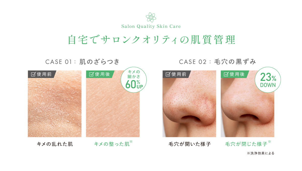 自宅でサロンクオリティの肌質管理