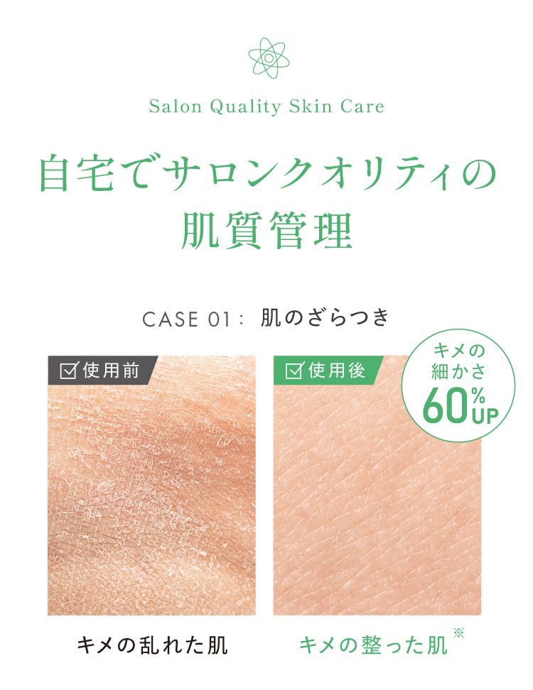 自宅でサロンクオリティの肌質管理